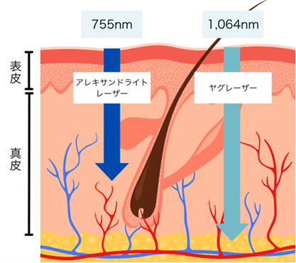 	高い出力をハイスピードに照射